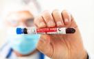 Un científico sujeta una muestra de sangre para hacer un análisis de hepatitis C