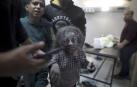 Una niña herida en los ataques aéreos israelíes sobre el sur de Gaza llega al Hospital Nasser en Khan Yunis, sur de la Franja de Gaza, este 7 de diciembre