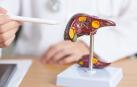 El hígado graso es la enfermedad hepática más común en nuestros días y un problema de salud reconocido.