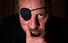 Ray Loriga, con un parche en el ojo derecho tras el tumor cerebral, el viernes en Pamplona