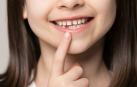 Los dientes temporales son conocidos como los famosos dientes de leche