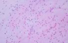 Vista de esperma humano al microscopio