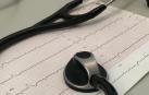 Un electrocardiograma
