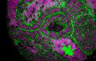 Imagen del estudio sobre los genes germinales y su papel en el desarrollo de tumores cerebrales en la mosca Drosophila