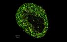 Imagen de altísima resolución de una célula cancerosa HeLa. La imagen utiliza dos colores para mostrar componentes nucleares que permiten ver estructuras detalladas dentro del núcleo celular con una resolución nanométrica