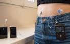 Modelos de sistemas integrados para la diabetes tipo 1 empleados actualmente en el SNS