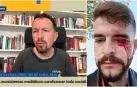 Momento del vídeo en el que Pablo Iglesias acusa al periodista apaleado en Pamplona de ser un infiltrado de la policía.